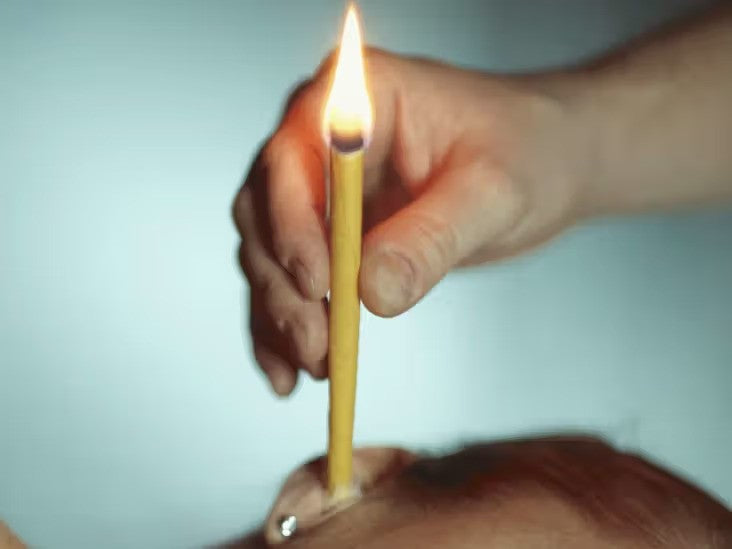 Prirodne svijeće za čišćenje ušiju - 20 komada