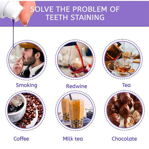 SmileKit – Pasta za Izbjeljivanje Zuba sa V34 Tehnologijom