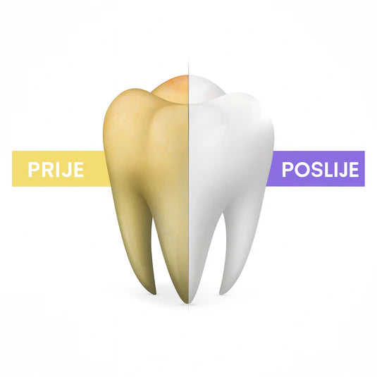 SmileKit – Pasta za Izbjeljivanje Zuba sa V34 Tehnologijom