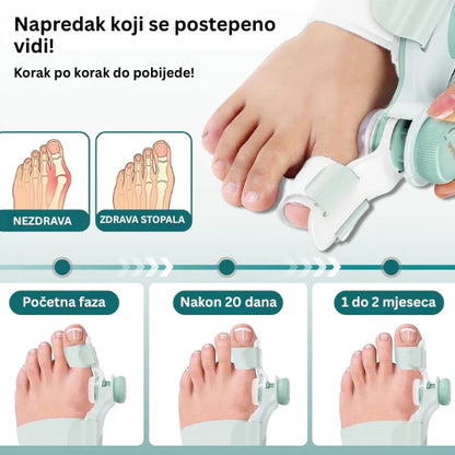 Ortopedsko Pomagalo Za Stopala
